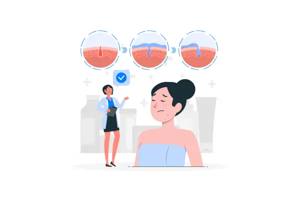 Understanding Hormonal Acne and its Connection to PCOS