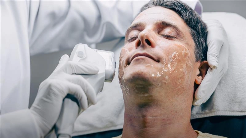 Laser Treatments for Pigmentation