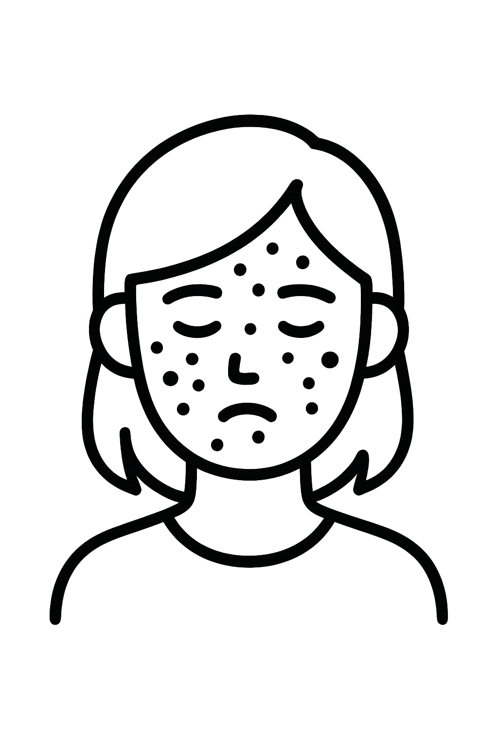 Chronic acne