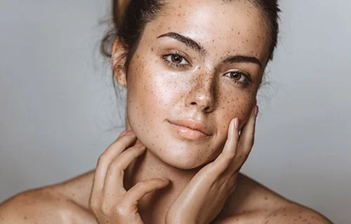 Pigmentation Treatment