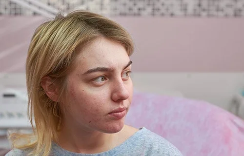 Open Pores Treatment