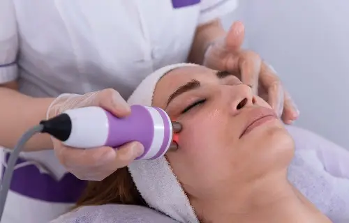 Laser Skin Resurfacing