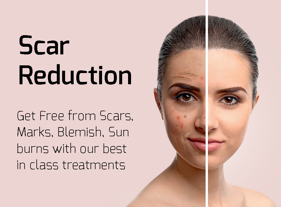 Mobile carousel image 1