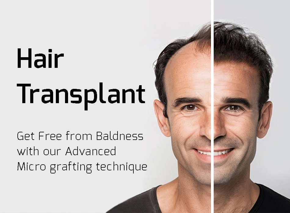 Mobile carousel image 2