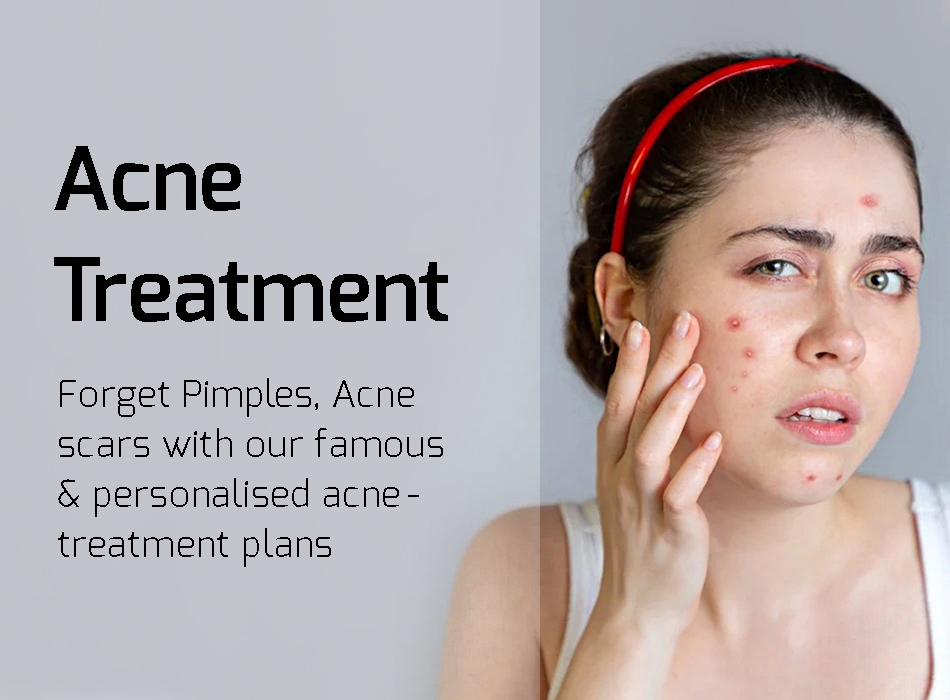 Mobile carousel image 3