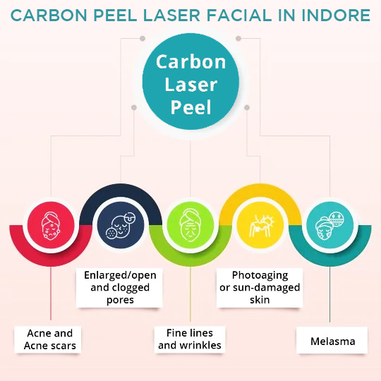 What Concerns can be Addressed by Carbon Laser Peel Treatment?