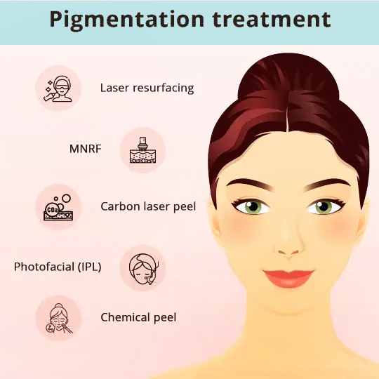 How can Hyperpigmentation be Treated? - Types of Pigmentation Treatment: Laser Resurfacing, MNRF , Carbon Laser Peel